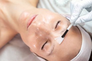 Renew and Rejuvenate with Chemical Peels
