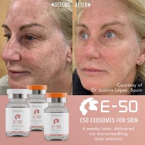 E50-SKIN Flux Skin Clinic
